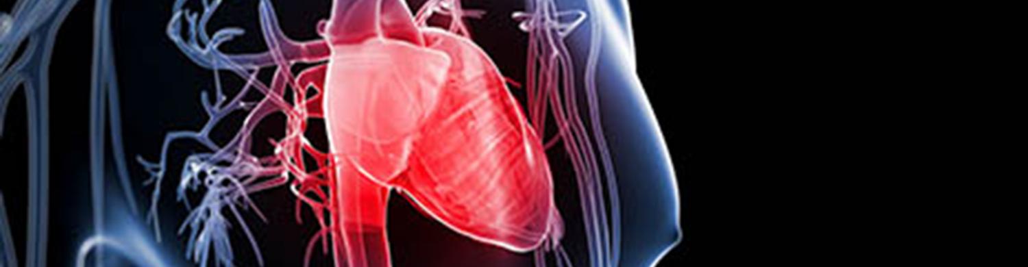 La maladie cardiovasculaire. 
