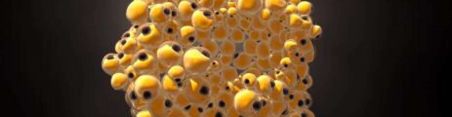 obesite